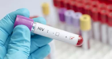 Primeira mulher tem cura do HIV relatada após transplante de células-tronco