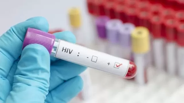 Primeira mulher tem cura do HIV relatada após transplante de células-tronco