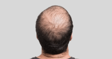 Cientistas anunciam fórmula que faz o cabelo “renascer” em 20 dias e reacende debate sobre o fim da calvície